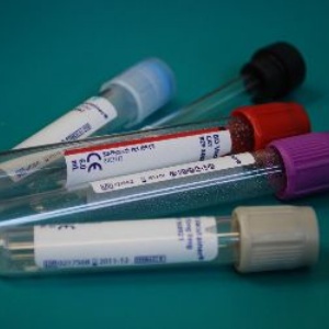 NHS National Work Experience Applications Open